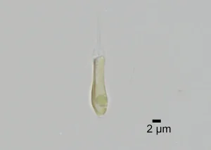 【サイエンス10大ニュース】微細藻類研究：窒素固定の発見が科学の新たな扉を開く